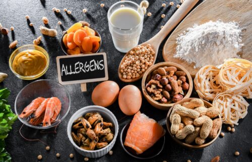 food allergies